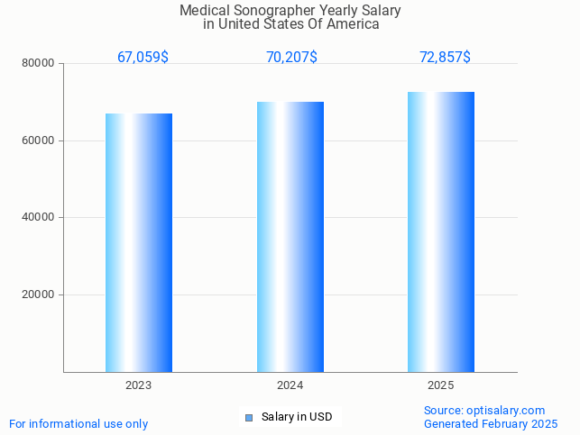 medical sonographer salary in united states of america 2025 medical sonographer salary in united states of america 2025
